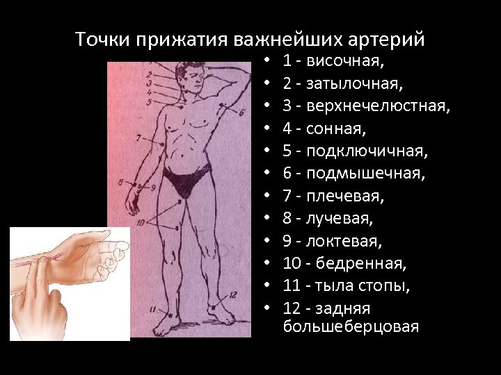 Точки прижатия важнейших артерий • • • 1 - височная, 2 - затылочная, 3