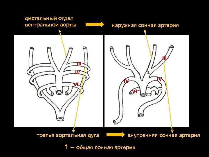 дистальный отдел вентральной аорты наружная сонная артерия III 1 IV VI IV IV VI