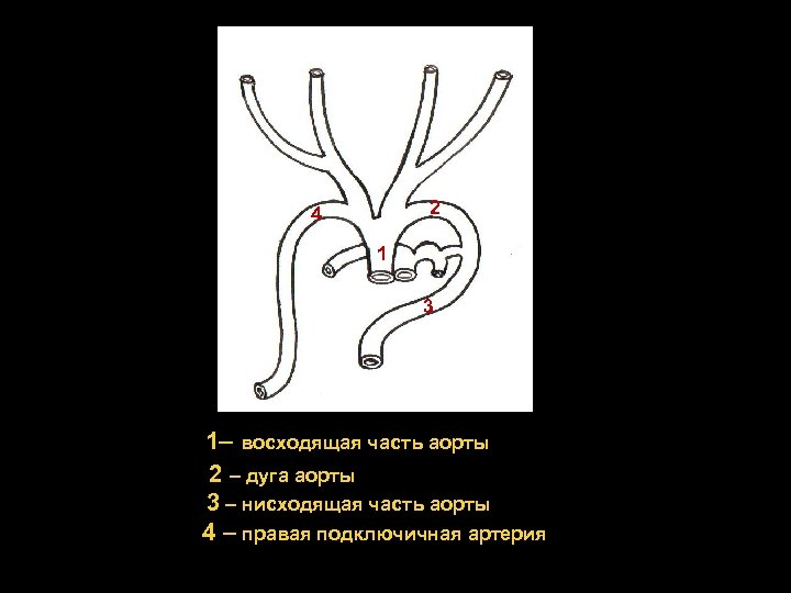 Схема артерий дуги аорты