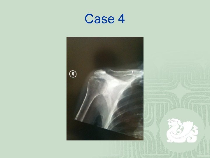 Case 4 