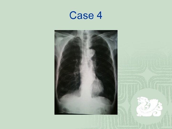 Case 4 