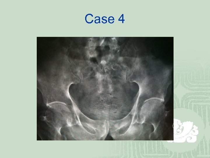 Case 4 