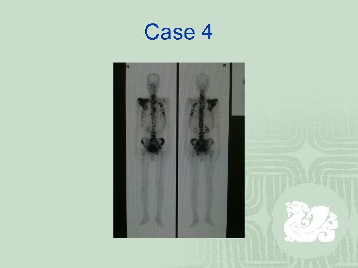 Case 4 