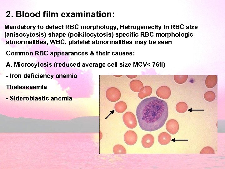 2. Blood film examination: Mandatory to detect RBC morphology, Hetrogenecity in RBC size (anisocytosis)