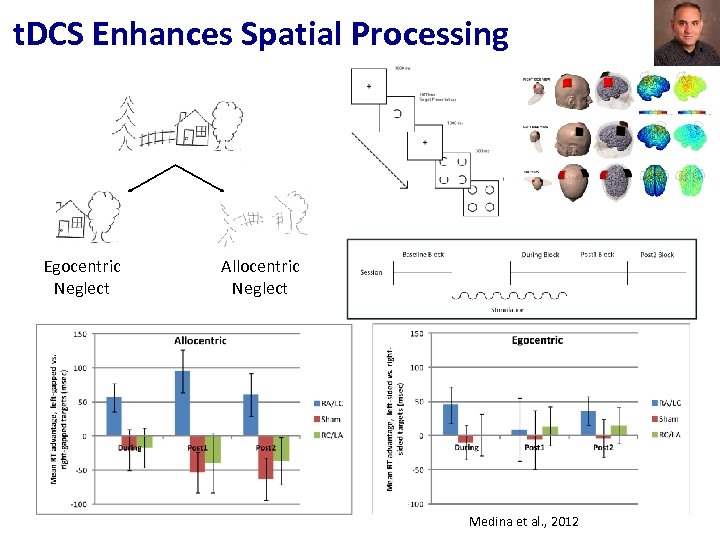 t. DCS Enhances Spatial Processing Egocentric Neglect Allocentric Neglect Medina et al. , 2012