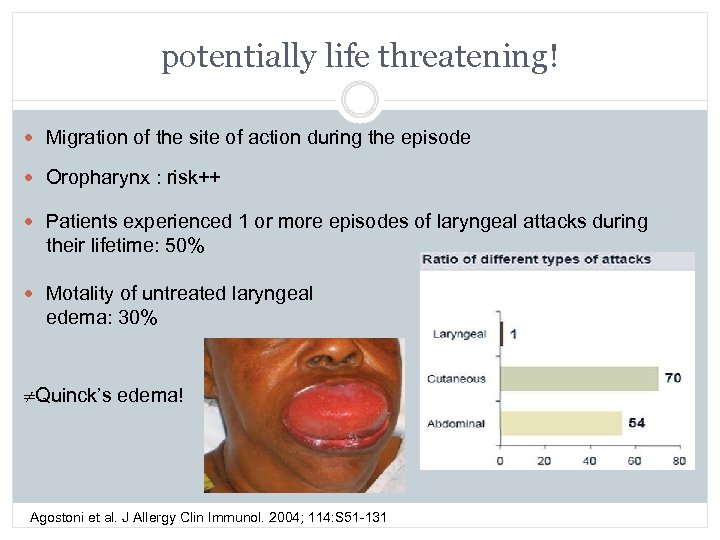 potentially life threatening! Migration of the site of action during the episode Oropharynx :