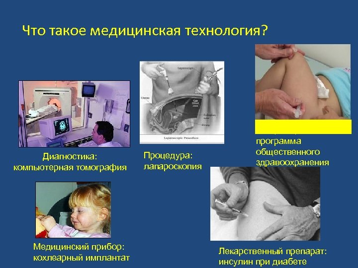Что такое медицинская технология? Диагностика: компьютерная томография Медицинский прибор: кохлеарный имплантат Процедура: лапароскопия Вакцинация