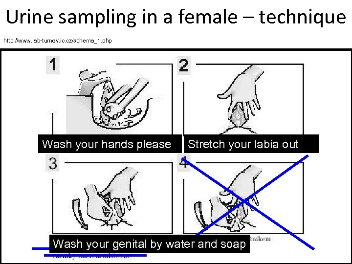 Urine sampling in a female – technique http: //www. lab-turnov. ic. cz/schema_1. php Wash