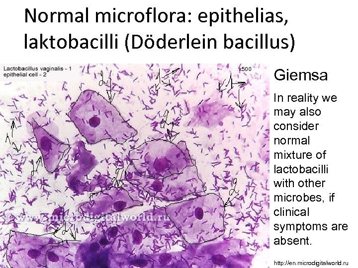 Normal microflora: epithelias, laktobacilli (Döderlein bacillus) Giemsa In reality we may also consider normal