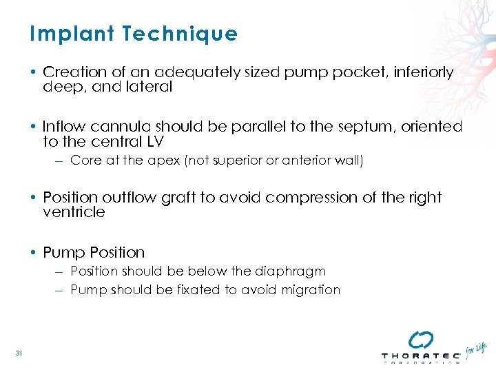 Implant Technique • Creation of an adequately sized pump pocket, inferiorly deep, and lateral