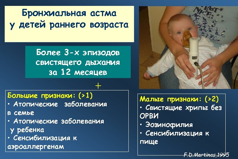 Бронхиальная астма у детей раннего возраста Более 3 -х эпизодов свистящего дыхания за 12