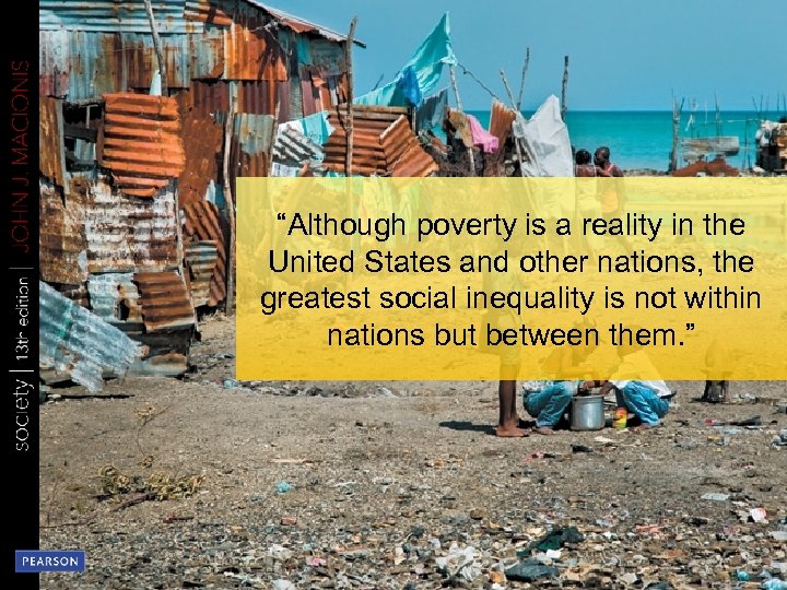 “Although poverty is a reality in the United States and other nations, the greatest