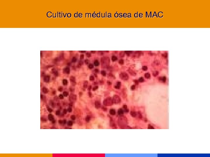 Cultivo de médula ósea de MAC 