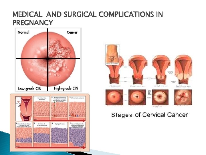 MEDICAL AND SURGICAL COMPLICATIONS IN PREGNANCY 