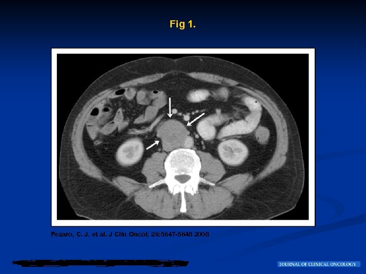 Fig 1. Pezaro, C. J. et al. J Clin Oncol; 26: 5647 -5648 2008