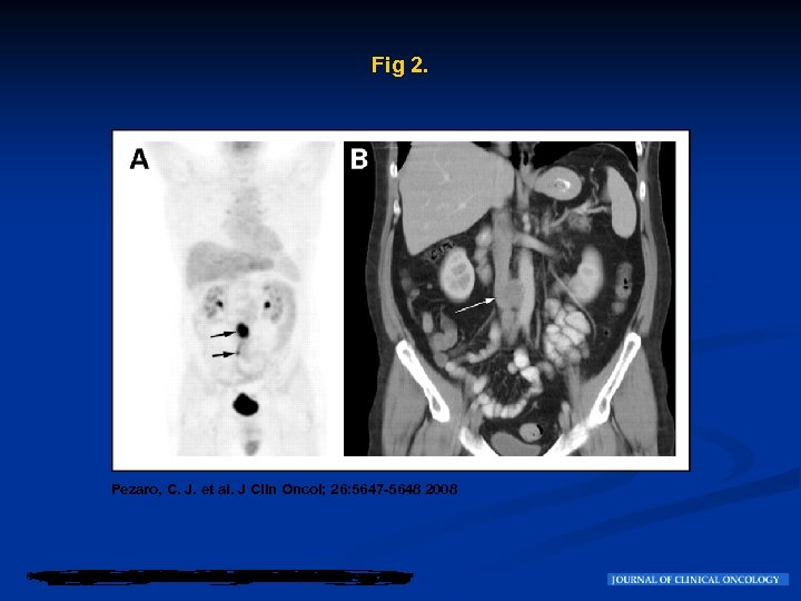 Fig 2. Pezaro, C. J. et al. J Clin Oncol; 26: 5647 -5648 2008