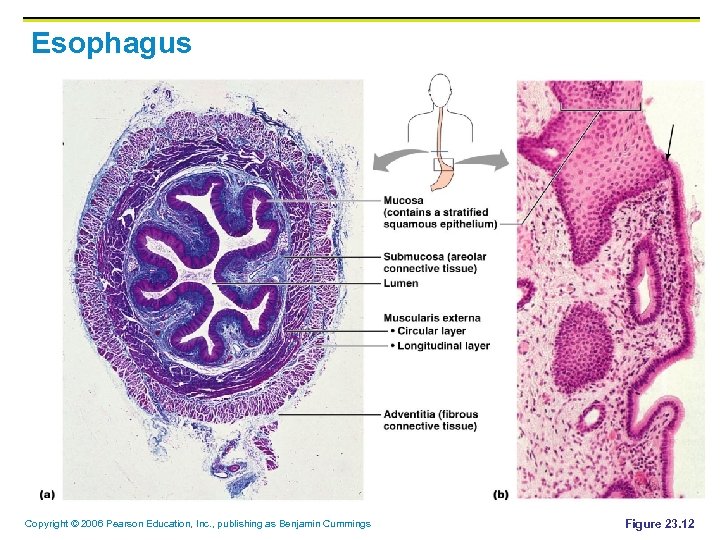 Esophagus Copyright © 2006 Pearson Education, Inc. , publishing as Benjamin Cummings Figure 23.