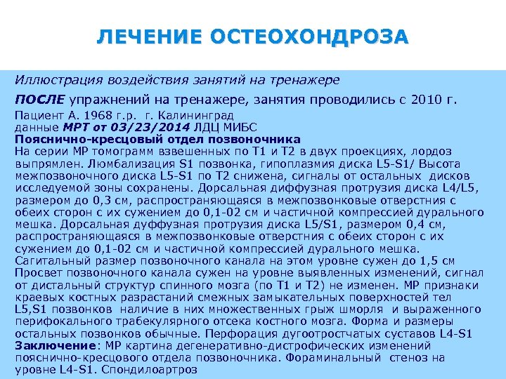 ЛЕЧЕНИЕ ОСТЕОХОНДРОЗА Иллюстрация воздействия занятий на тренажере ПОСЛЕ упражнений на тренажере, занятия проводились с