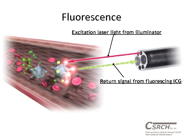 Fluorescence Excitation laser light from illuminator Return signal from fluorescing ICG 