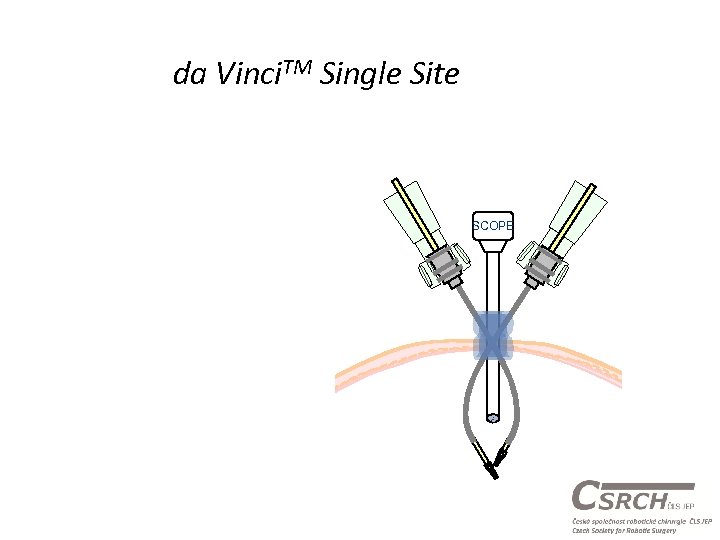 da Vinci. TM Single Site SCOPE 