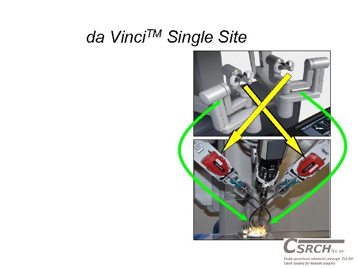 da Vinci. TM Single Site 