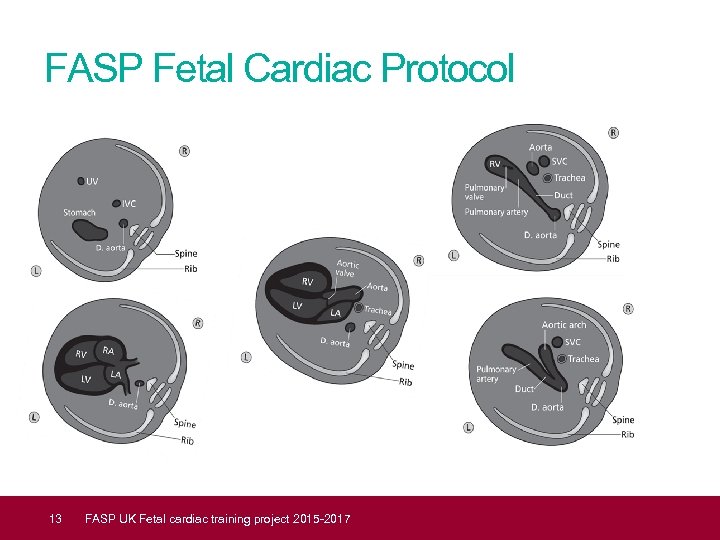 FASP Fetal Cardiac Protocol 13 FASP UK Fetal cardiac training project 2015 -2017 