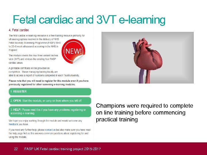 Fetal cardiac and 3 VT e-learning Champions were required to complete on line training