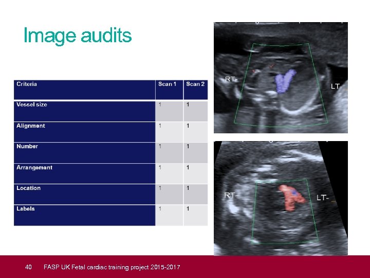 Image audits 40 FASP UK Fetal cardiac training project 2015 -2017 