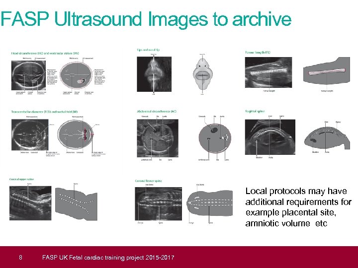 FASP Ultrasound Images to archive Local protocols may have additional requirements for example placental