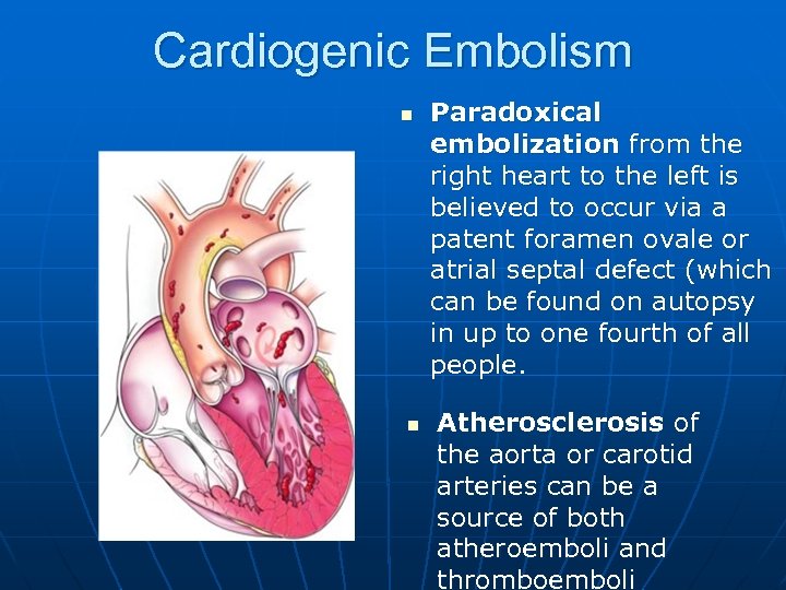 Cardiogenic Embolism n n Paradoxical embolization from the right heart to the left is