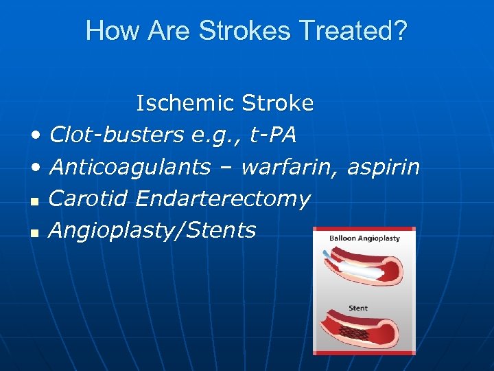 How Are Strokes Treated? Ischemic Stroke • Clot-busters e. g. , t-PA • Anticoagulants