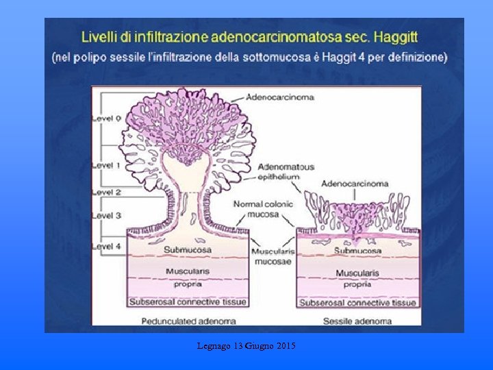 Legnago 13 Giugno 2015 
