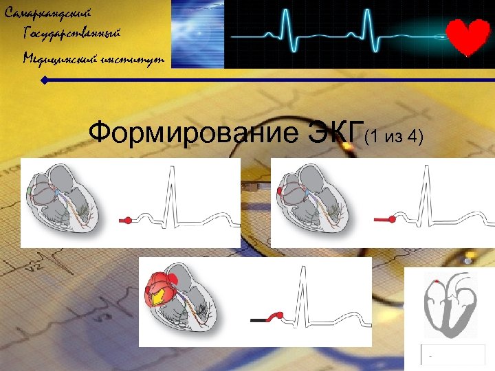 Самаркандский Государственный Медицинский институт Формирование ЭКГ(1 из 4) 