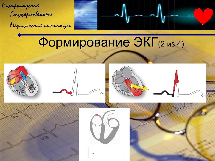 Самаркандский Государственный Медицинский институт Формирование ЭКГ(2 из 4) 