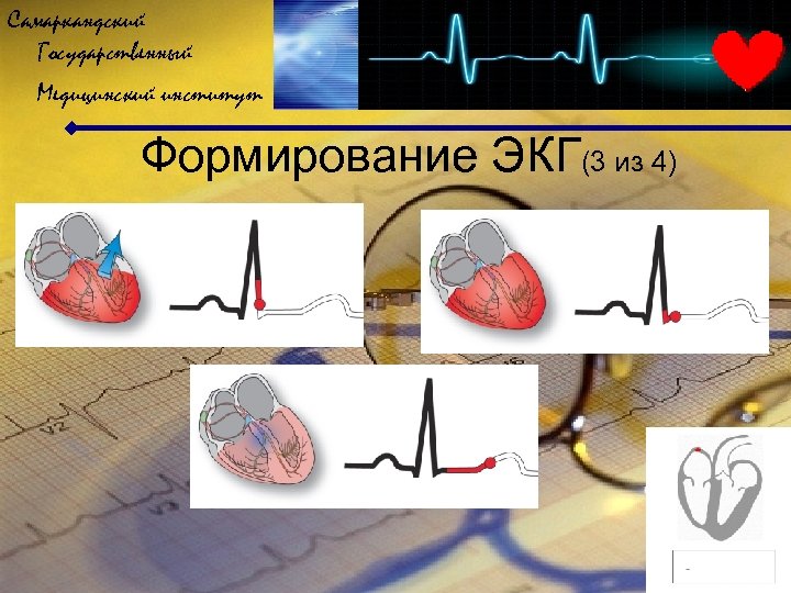 Самаркандский Государственный Медицинский институт Формирование ЭКГ(3 из 4) 