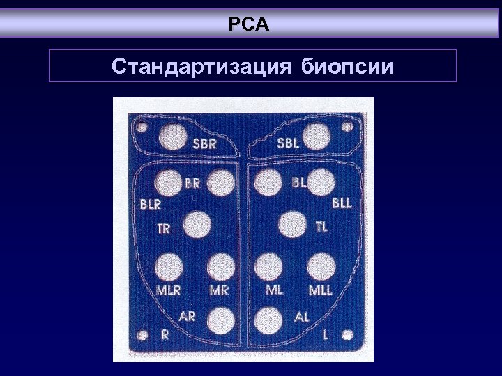 PCA Стандартизация биопсии 