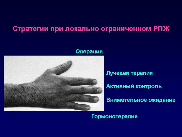 Стратегии при локально ограниченном РПЖ Операция Лучевая терапия Активный контроль Внимательное ожидание Гормонотерапия 