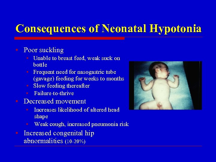 Consequences of Neonatal Hypotonia • Poor suckling • Unable to breast feed, weak suck