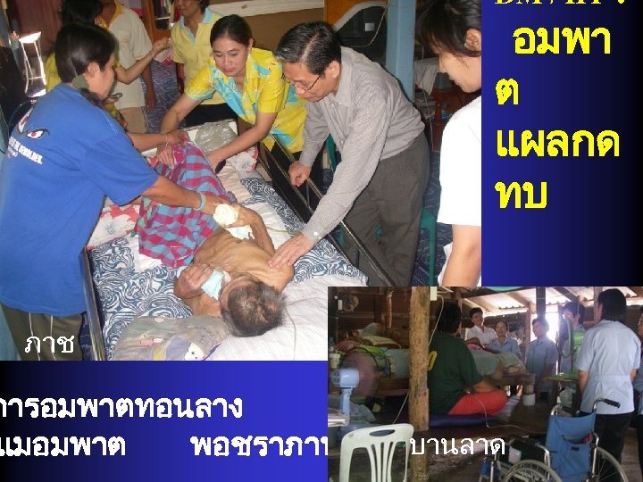 DM / HT : อมพา ต แผลกด ทบ ภาช การอมพาตทอนลาง แมอมพาต พอชราภาพ บานลาด 