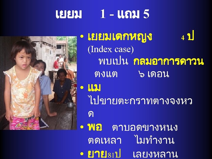 เยยม 1 - แถม 5 • เยยมเดกหญง 4 ป (Index case) พบเปน กลมอาการดาวน ตงแต