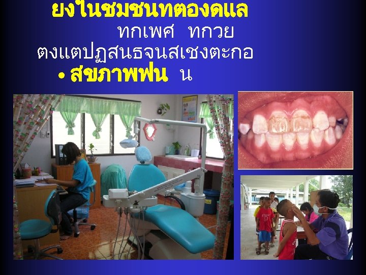 ยงในชมชนทตองดแล ทกเพศ ทกวย ตงแตปฏสนธจนสเชงตะกอ • สขภาพฟน น 