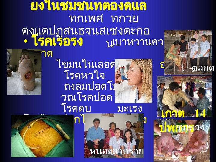 ยงในชมชนทตองดแล ทกเพศ ทกวย ตงแตปฏสนธจนสเชงตะกอ • โรคเรอรง นเบาหวานความดนสง เกาต ไขมนในเลอดสง โรคหวใจ หด ถงลมปอดโปงพอง วณโรคปอด เ