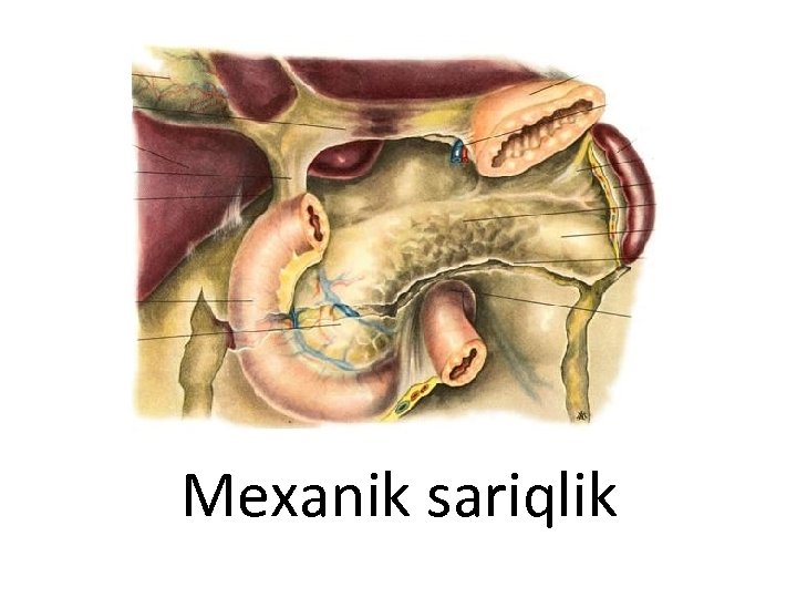 Mexanik sariqlik 