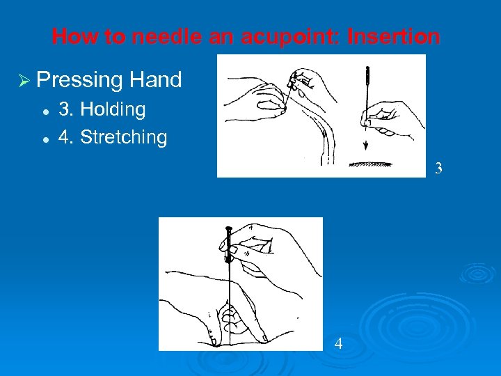 How to needle an acupoint: Insertion Ø Pressing Hand l l 3. Holding 4.