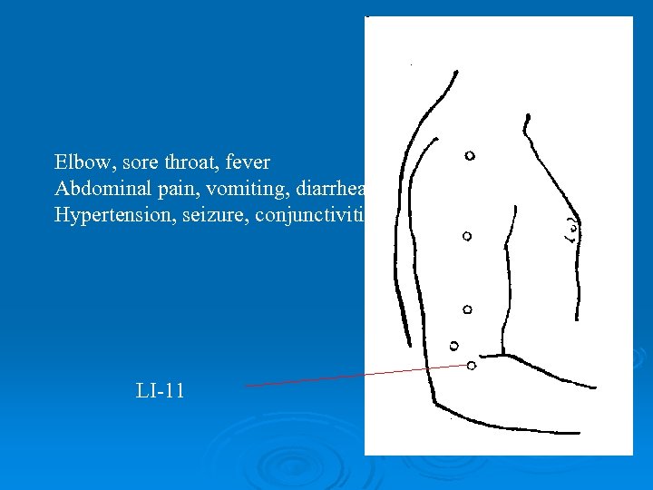 Elbow, sore throat, fever Abdominal pain, vomiting, diarrhea Hypertension, seizure, conjunctivitis LI-11 