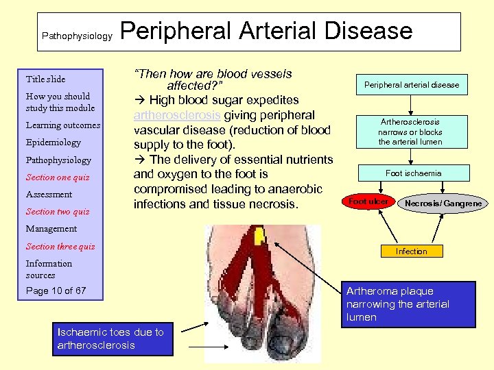 Pathophysiology Title slide How you should study this module Learning outcomes Epidemiology Pathophysiology Section