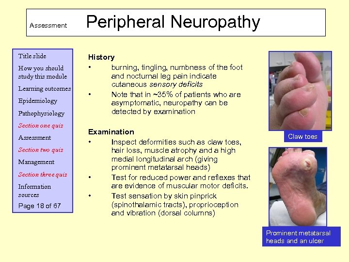 Assessment Title slide How you should study this module Learning outcomes Epidemiology Pathophysiology Section