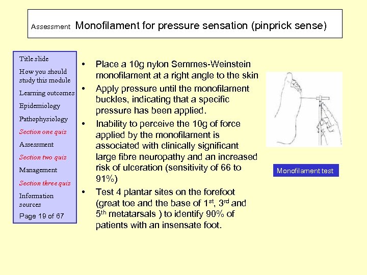 Assessment Title slide How you should study this module Learning outcomes Monofilament for pressure