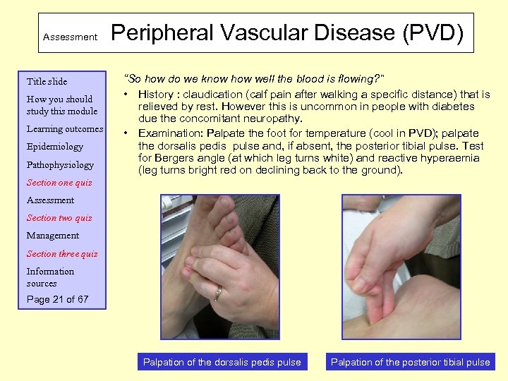 Assessment Title slide How you should study this module Learning outcomes Epidemiology Pathophysiology Peripheral