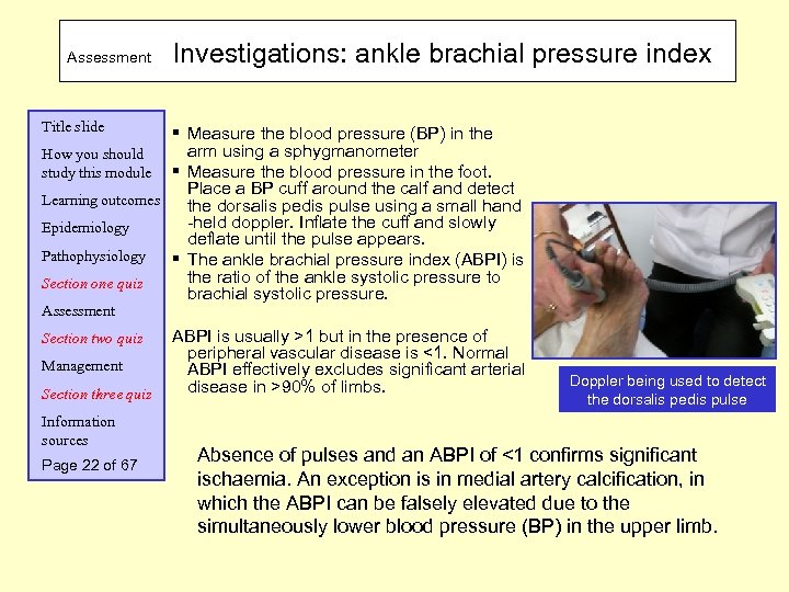 Assessment Investigations: ankle brachial pressure index Title slide § Measure the blood pressure (BP)